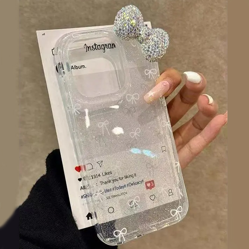 Luxury Watch Case - Luxo espumante pó 3d cheio de